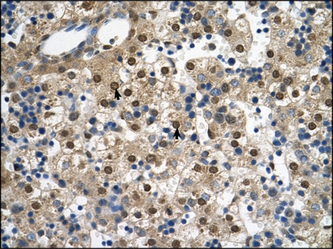 Anti-SQLE antibody produced in rabbit affinity isolated antibody