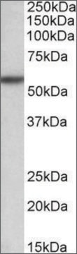 Anti-TGFBR1 antibody produced in goat affinity isolated antibody, buffered aqueous solution