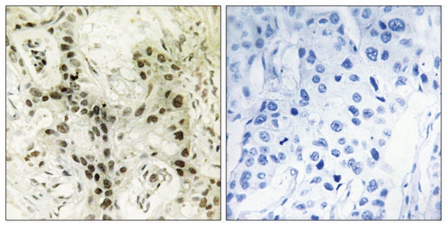 Anti-FOXI1 antibody produced in rabbit affinity isolated antibody