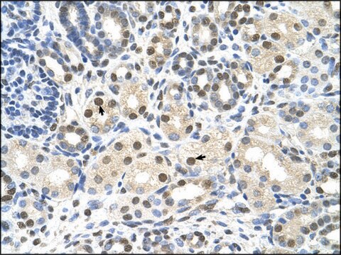 Anti-CACNB1 (AB2) antibody produced in rabbit affinity isolated antibody