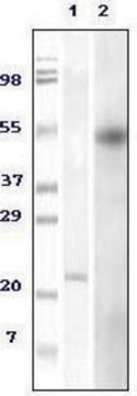 Monoclonal Anti-FOXP3 antibody produced in mouse clone 2A11G9, ascites fluid