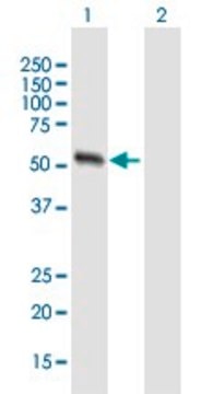 Anti-MMP13 antibody produced in mouse purified immunoglobulin, buffered aqueous solution