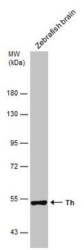 Anti-th antibody produced in rabbit affinity isolated antibody, buffered aqueous solution