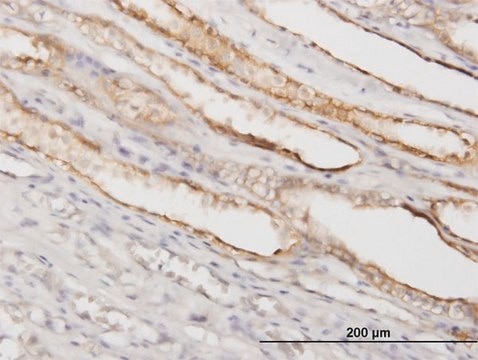 Monoclonal Anti-PGGT1B antibody produced in mouse clone 5E4, purified immunoglobulin, buffered aqueous solution