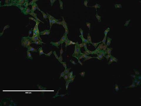 VERO Cell Line from African green monkey kidney, 84113001, A fibroblast-like kidney cell, non-WHO origin, Convention on International Trade in Endangered Species of Wild Fauna and Flora (CITES)