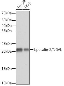 Anti-Lipocalin-2/NGAL antibody produced in rabbit