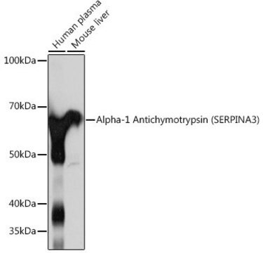 Anti-Alpha-1 Antichymotrypsin (SERPINA3) antibody produced in rabbit