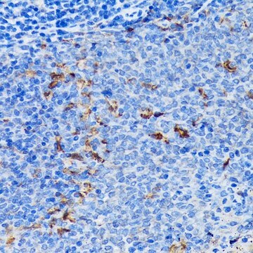 Anti-Fascin/FSCN1 antibody produced in rabbit