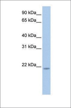 Anti-RNF5 antibody produced in rabbit affinity isolated antibody