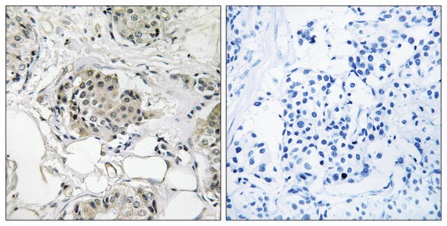 Anti-USP13 antibody produced in rabbit affinity isolated antibody