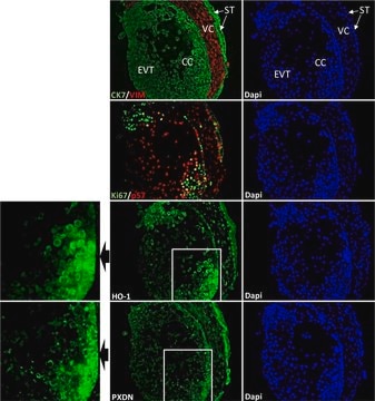 Anti-Ki-67 Antibody, clone Ki-S5 clone Ki-S5, Chemicon&#174;, from mouse