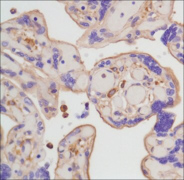 Anti-beta-Actin antibody, Rabbit monoclonal clone SP124, recombinant, expressed in proprietary host, affinity isolated antibody