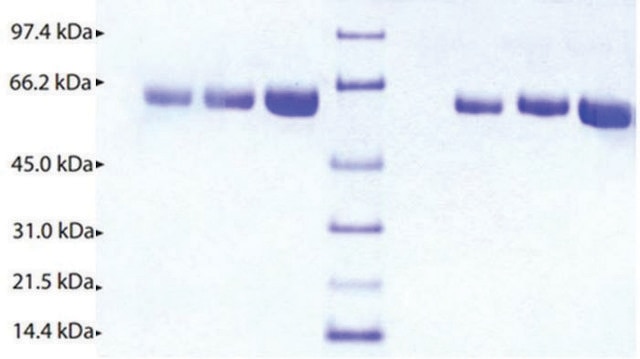 Alpha 2 Antiplasmin from human plasma &#8805;95% (SDS-PAGE)