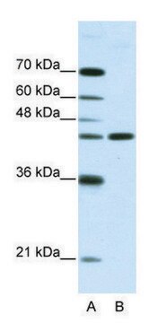 Anti-NMUR2 (N-terminal) antibody produced in rabbit affinity isolated antibody