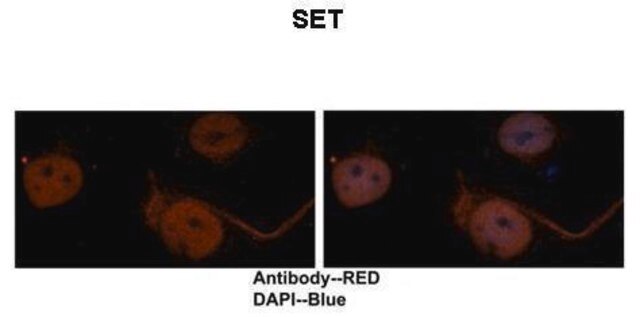 Anti-SET, (N-terminal) antibody produced in rabbit affinity isolated antibody