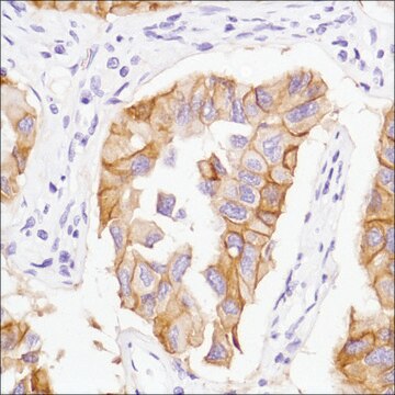 Anti-EGFR antibody, Rabbit monoclonal recombinant, expressed in proprietary host, clone SP125, affinity isolated antibody