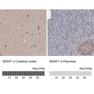 Anti-GDAP1 antibody produced in rabbit Prestige Antibodies&#174; Powered by Atlas Antibodies, affinity isolated antibody, buffered aqueous glycerol solution