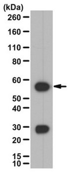 Anti-Calcineurin A/PP2B catalytic unit Antibody from rabbit, purified by affinity chromatography