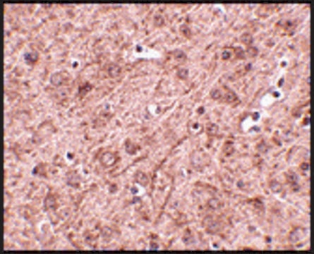 Anti-LASS6 antibody produced in rabbit affinity isolated antibody, buffered aqueous solution