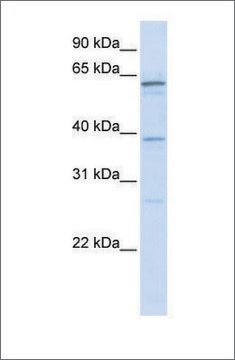 Anti-RBM39 antibody produced in rabbit affinity isolated antibody