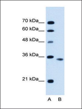 Anti-ACVR2B antibody produced in rabbit affinity isolated antibody