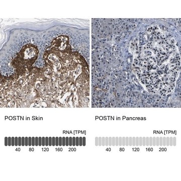 Anti-POSTN antibody produced in rabbit Prestige Antibodies&#174; Powered by Atlas Antibodies, affinity isolated antibody, buffered aqueous glycerol solution