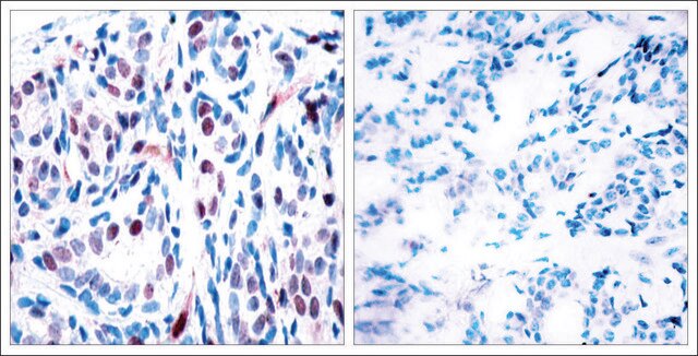 Anti-phospho-STAT3 (pTyr705) antibody produced in rabbit affinity isolated antibody