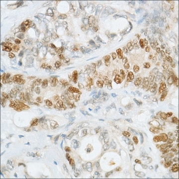 Anti-MSH6 antibody, Rabbit monoclonal clone SP93, recombinant, expressed in proprietary host, affinity isolated antibody