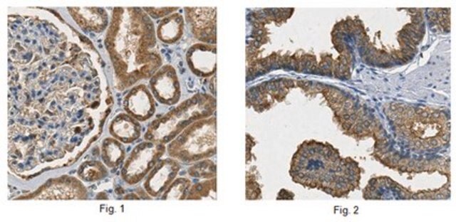 Anti-Annexin A3 Antibody from rabbit, purified by affinity chromatography