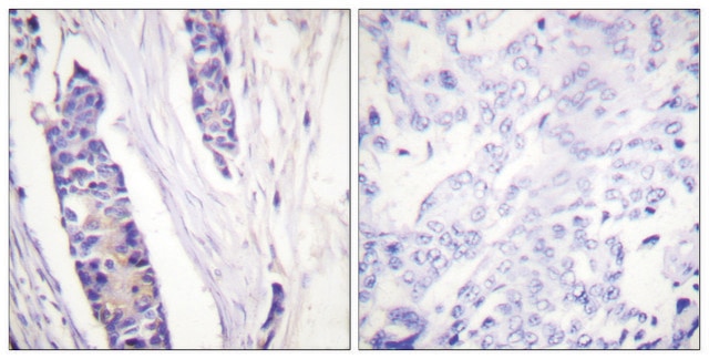 Anti-Tubulin &#946; antibody produced in rabbit affinity isolated antibody