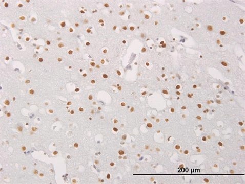 Monoclonal Anti-MECP2 antibody produced in mouse clone 1B11, purified immunoglobulin, buffered aqueous solution