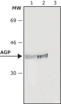 Monoclonal Anti-&#945;1-Acid Glycoprotein antibody produced in mouse clone AGP-47, ascites fluid