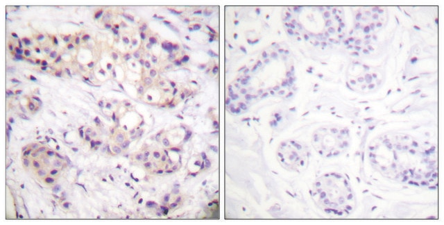 Anti-PKC &#945; antibody produced in rabbit affinity isolated antibody