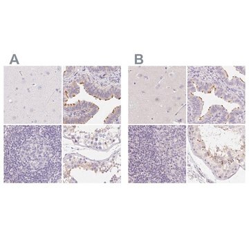 Anti-ZBBX antibody produced in rabbit Prestige Antibodies&#174; Powered by Atlas Antibodies, affinity isolated antibody, buffered aqueous glycerol solution