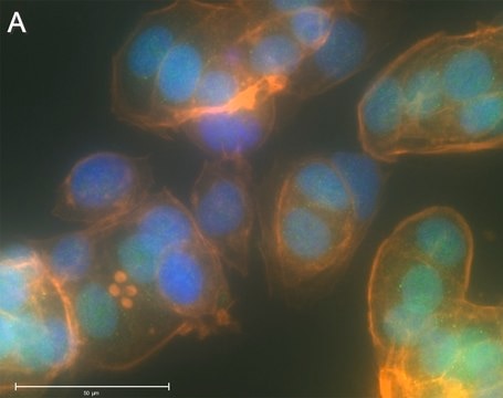 Anti-RAR&#947;1 Antibody, clone 1C22 ZooMAb&#174; Rabbit Monoclonal recombinant, expressed in HEK 293 cells