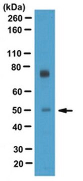 Anti-T-box transcription factor TBX5 Antibody serum, from rabbit