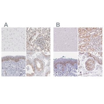 Anti-SYNE2 antibody produced in rabbit Prestige Antibodies&#174; Powered by Atlas Antibodies, affinity isolated antibody, buffered aqueous glycerol solution