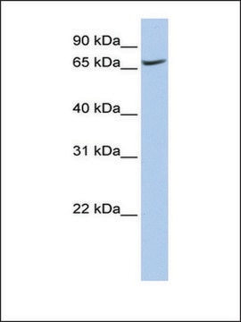 Anti-ATP6V0A1 antibody produced in rabbit affinity isolated antibody