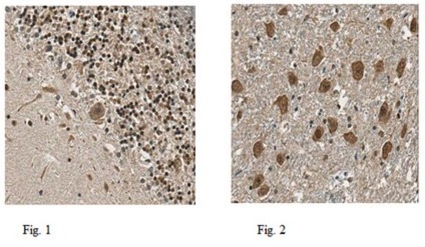 Anti-NSD2 Antibody from rabbit, purified by affinity chromatography