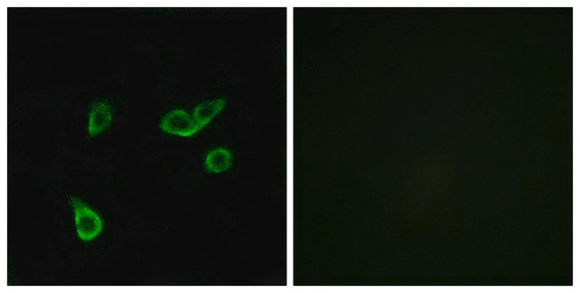 Anti-GPR35 antibody produced in rabbit affinity isolated antibody