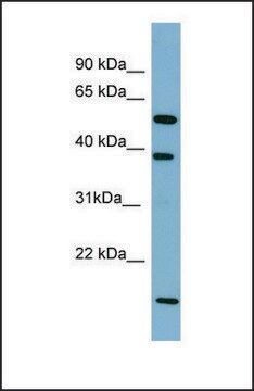 Anti-SLC10A1 affinity isolated antibody