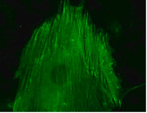 LentiBrite &#945;-actinin-GFP Lentiviral Biosensor