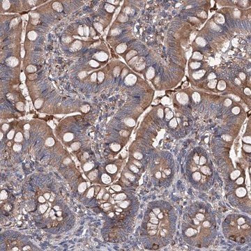 Anti-INPP5B antibody produced in rabbit Prestige Antibodies&#174; Powered by Atlas Antibodies, affinity isolated antibody, buffered aqueous glycerol solution