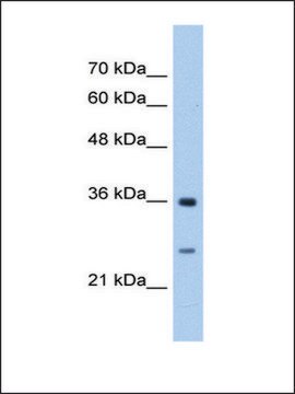 Anti-GSTZ1 antibody produced in rabbit IgG fraction of antiserum