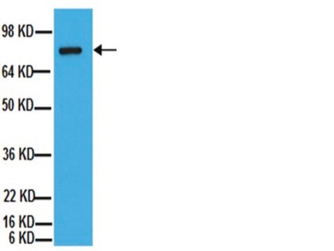 Anti-ADAM 10 Antibody, CT Chemicon&#174;, from rabbit