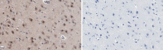 Anti-AIDA1 Antibody, clone 2B22