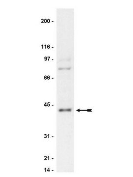 Anti-PKA Antibody, NT Upstate&#174;, from rabbit