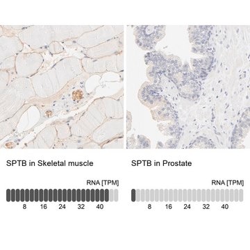 Anti-SPTB antibody produced in rabbit Ab1, Prestige Antibodies&#174; Powered by Atlas Antibodies, affinity isolated antibody, buffered aqueous glycerol solution