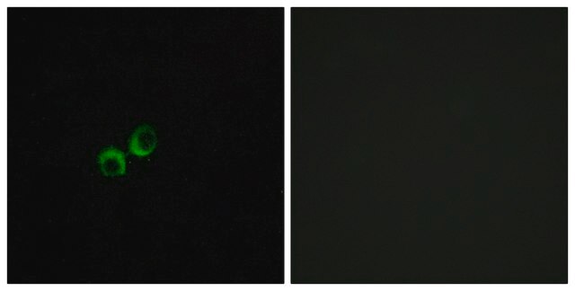 Anti-TAS1R3 antibody produced in rabbit affinity isolated antibody