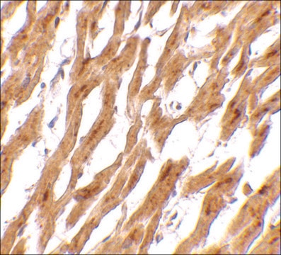 Anti-ASAH1 antibody produced in rabbit affinity isolated antibody, buffered aqueous solution